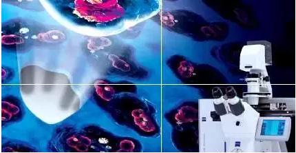 激光顯微切割技術(shù)(LCM) 激光顯微切割技術(shù)(LCM)