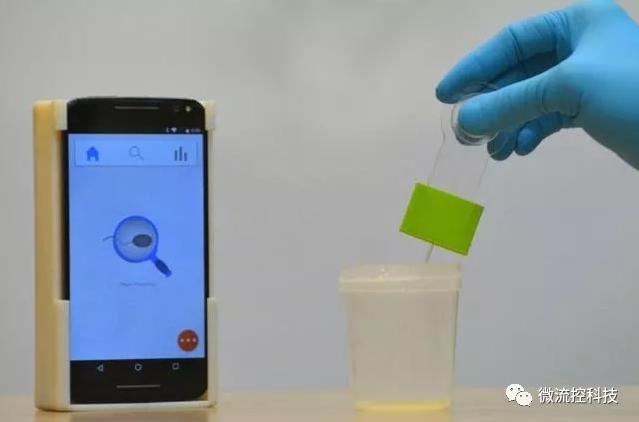 微流控芯片結(jié)合智能手機可測試男性生育能力