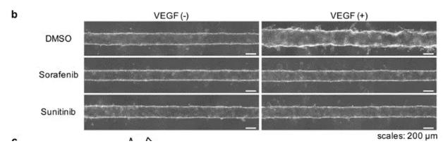向芯片中添加抗腫瘤藥物sorafenib或sunitinib，觀察到了血管新生的抑制現象。 圖片來源：EBioMedicine