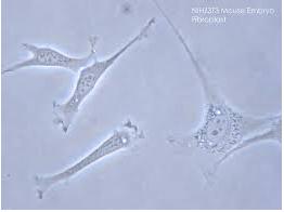 細胞培養損傷 細胞培養損傷