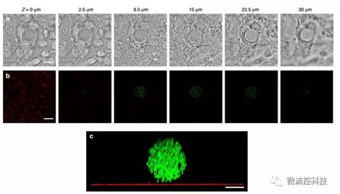 微流控技術開發微型彈性球，可用于癌癥診斷